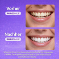 Pure Smile Whitening-Streifen